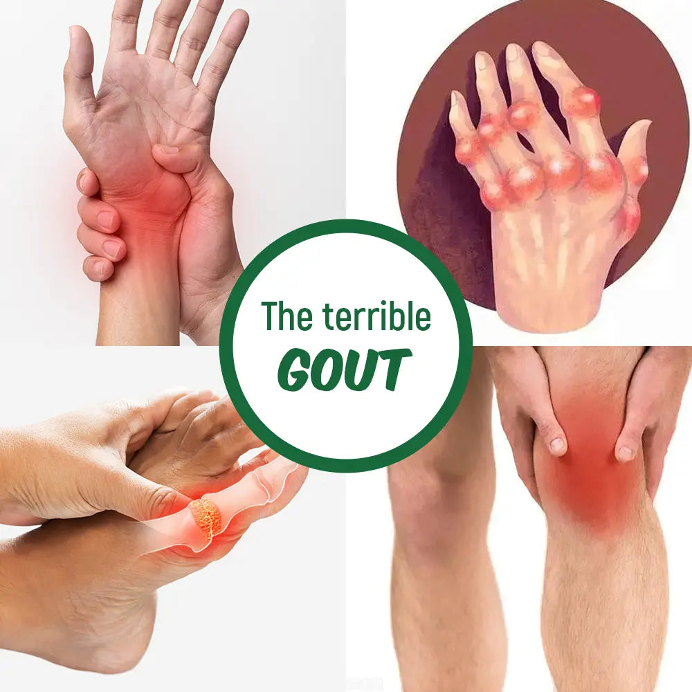 What are the symptoms of gout?