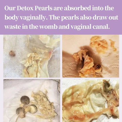 Hiherbs Yoni Detox Pearls for Pcos Cyst Cramps BV Yeast Infections Vaginal detox pearls/Qinggong pills(6-15 Pcs) Hiherbs